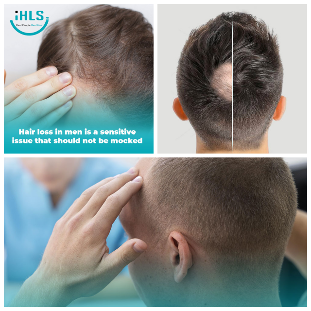 Review Innovative hair loss solutions image 300522