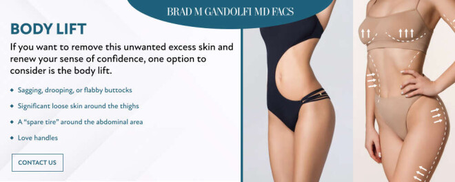 Review Dr. Brad M. Gandolfi, MD image 359275