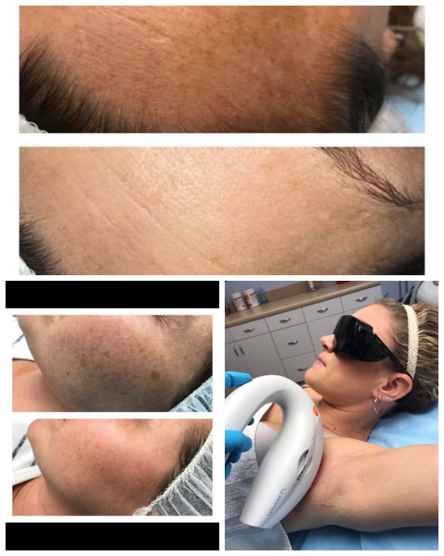 Review Nouveauderm medspa image 329387