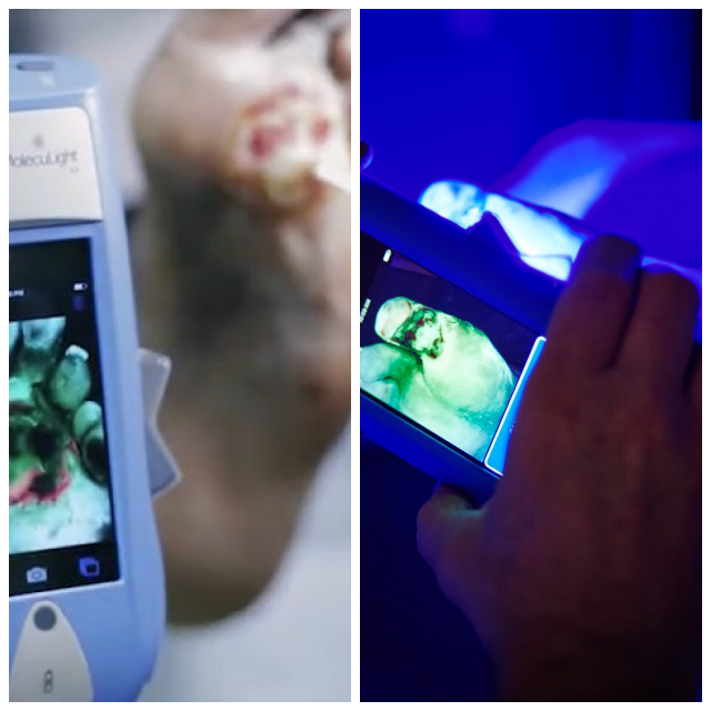 Review MolecuLight image 151704