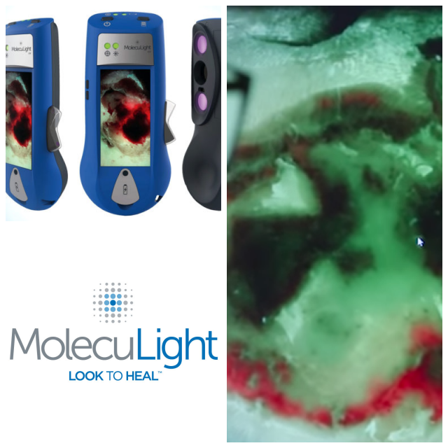 Review MolecuLight image 151706