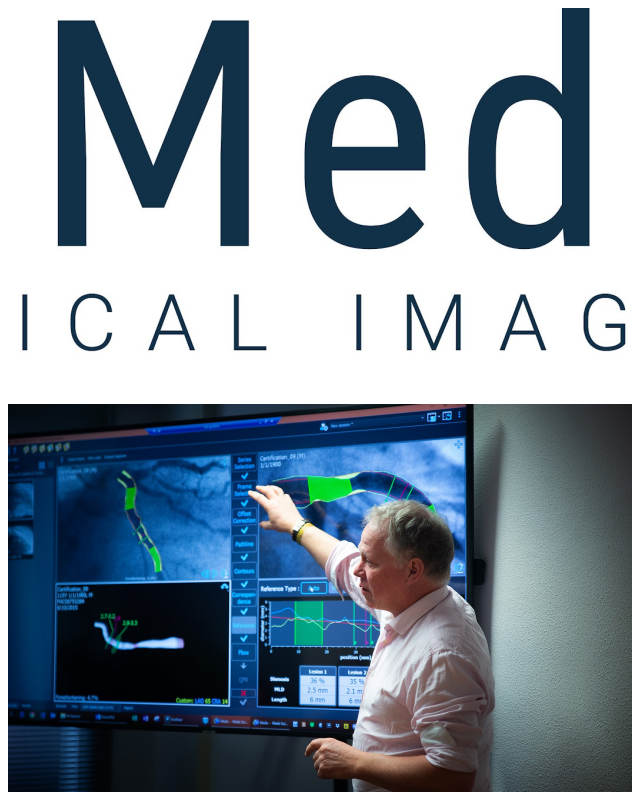 Review Medis medical imaging systems bv image 155876