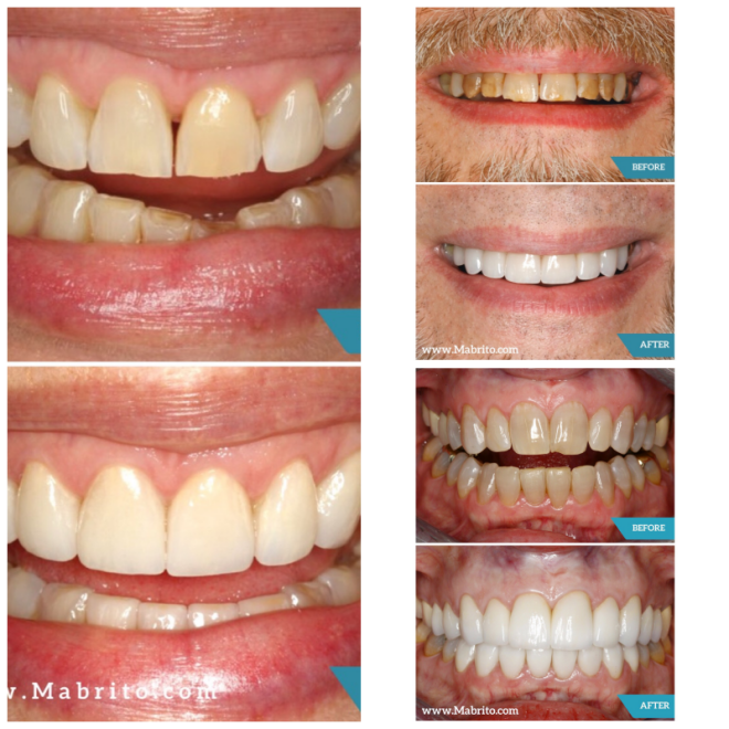 Review Mabrito dental image 315982