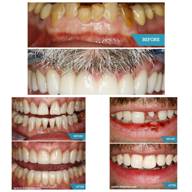Review Mabrito dental image 315983