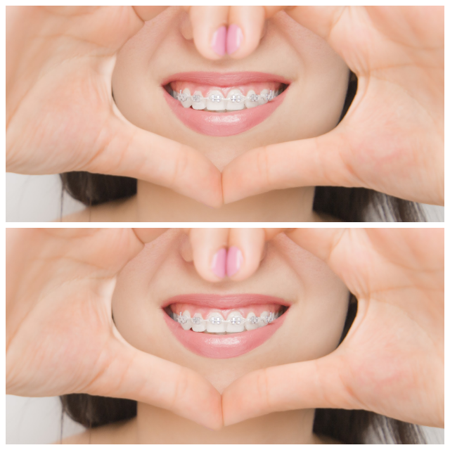 Review Quintero orthodontics image 342254