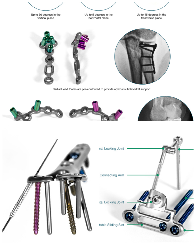 Review Skeletal dynamics, llc image 262770