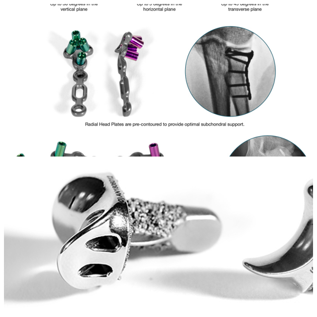 Review Skeletal dynamics, llc image 262771