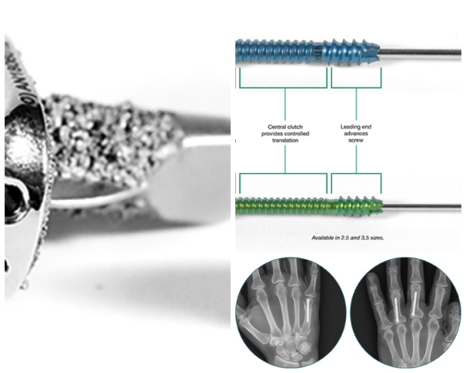 Review Skeletal dynamics, llc image 262772