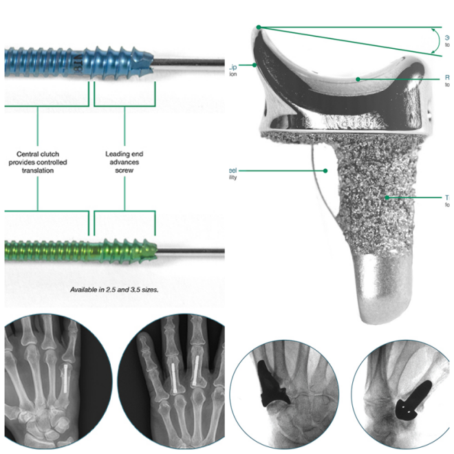 Review Skeletal dynamics, llc image 262774