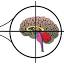 Brainaware